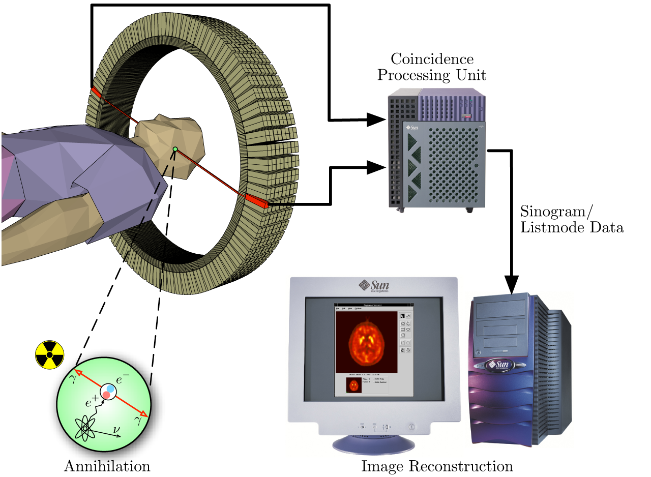PET scan